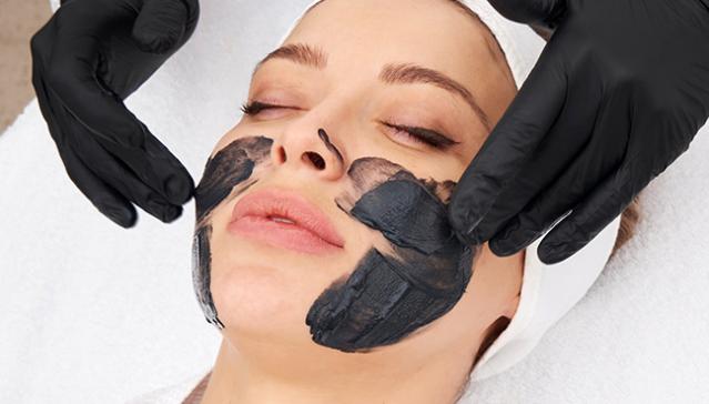 Carbon Peel