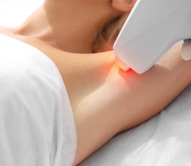 épilation définitive au laser
